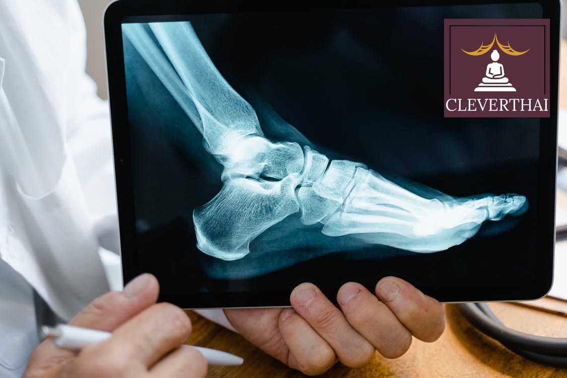 The 5 Most Trusted Podiatrist Clinics in Bangkok