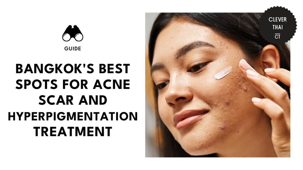 Top 5 Acne Scar and Hyperpigmentation Removal Services in Bangkok