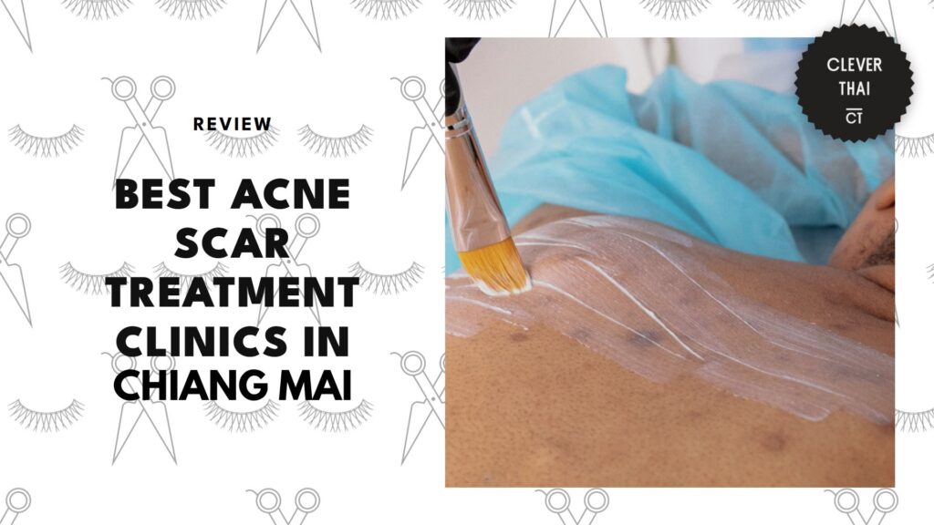 best-acne-scar-treatment-chiang-mai-banner