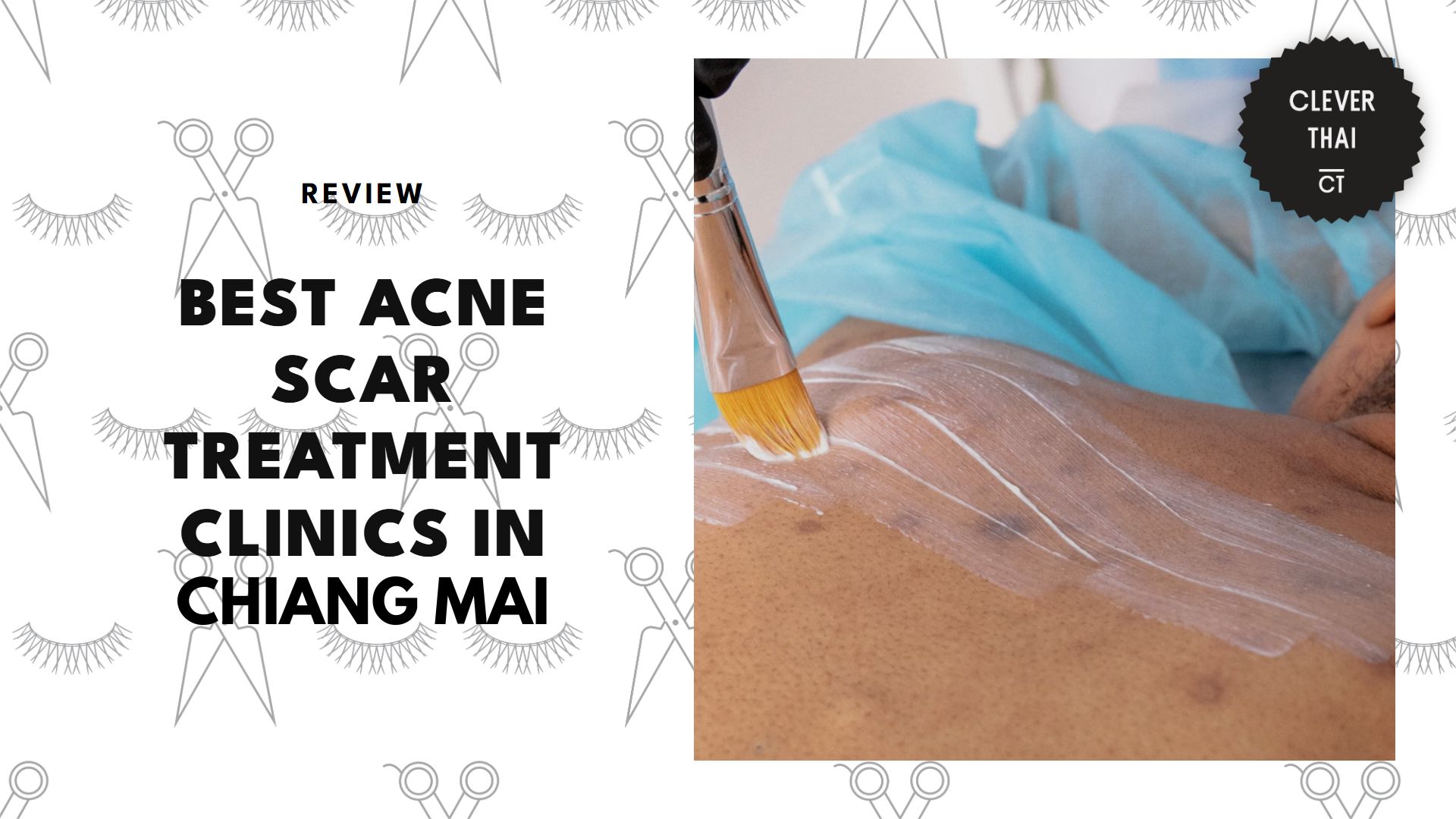 best-acne-scar-treatment-chiang-mai-banner